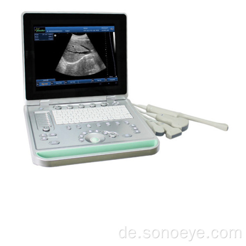 SS-9 Sonostar tragbarer Laptop-Ultraschallscanner